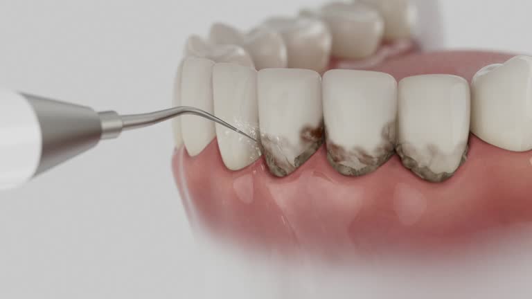 Trusted Dental Crowns And Bridges service in Mack, OH - Dentist Open Now